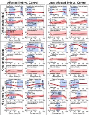 Unraveling stroke gait deviations with movement analytics, more than meets the eye: a case control study